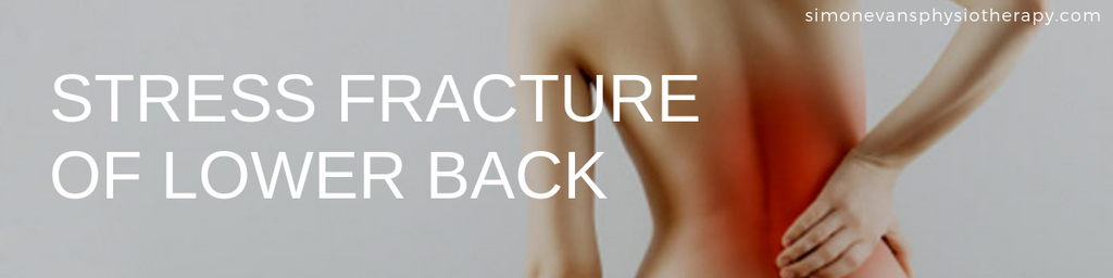 Stress Fracture of Lower Back