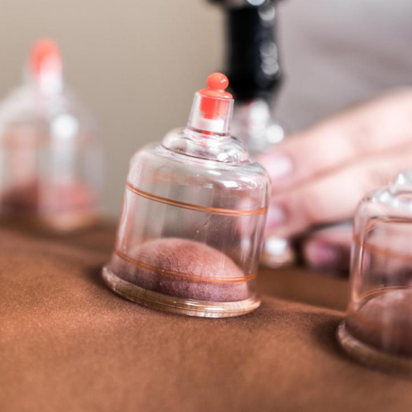 Cupping Therapy Solihull Simon Evans Physiotherapy